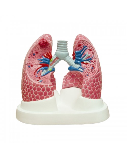 Anatomique modèle Poumon